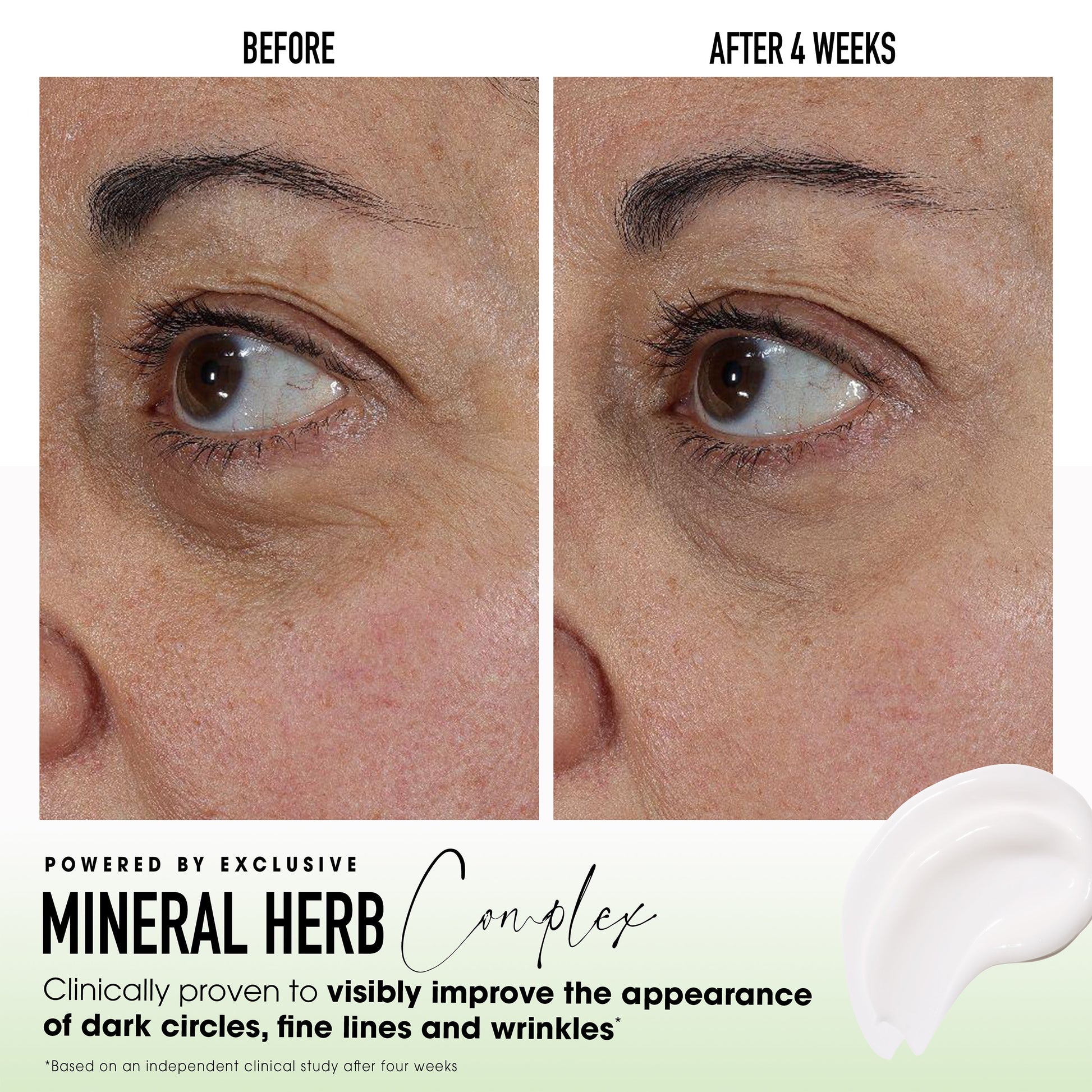 SKINLONGEVITY® Under-Eye Essentials Duo